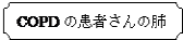 �u���[�`: COPD�̊��҂���̔x

